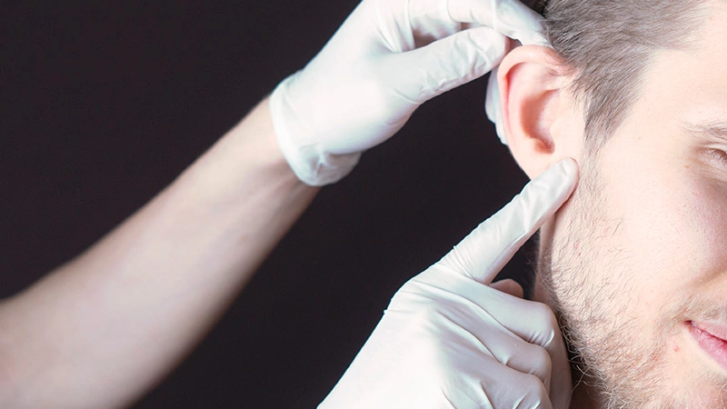 Ear Pinning Surgery Cost in Turkey